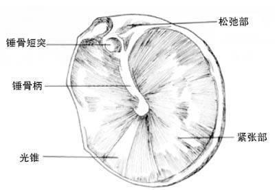 助听器